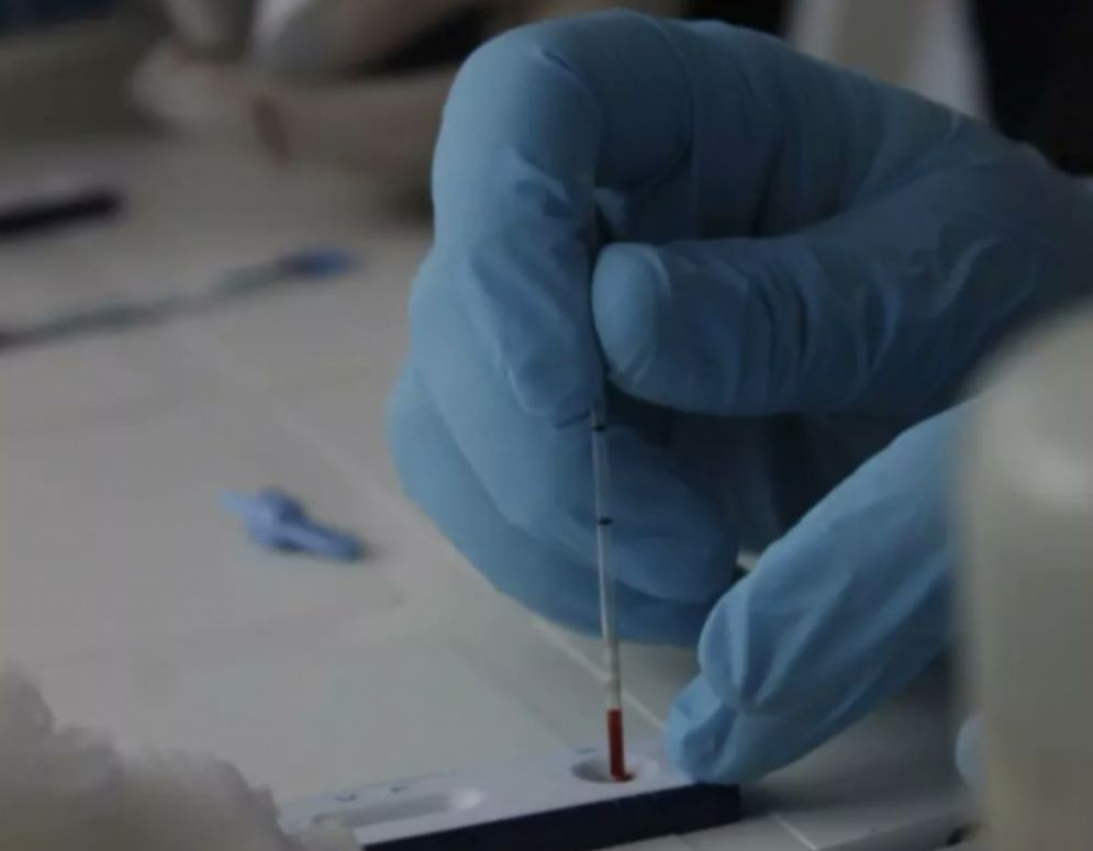 Podés hacerte un testeo rápido de infecciones de transmisión sexual
